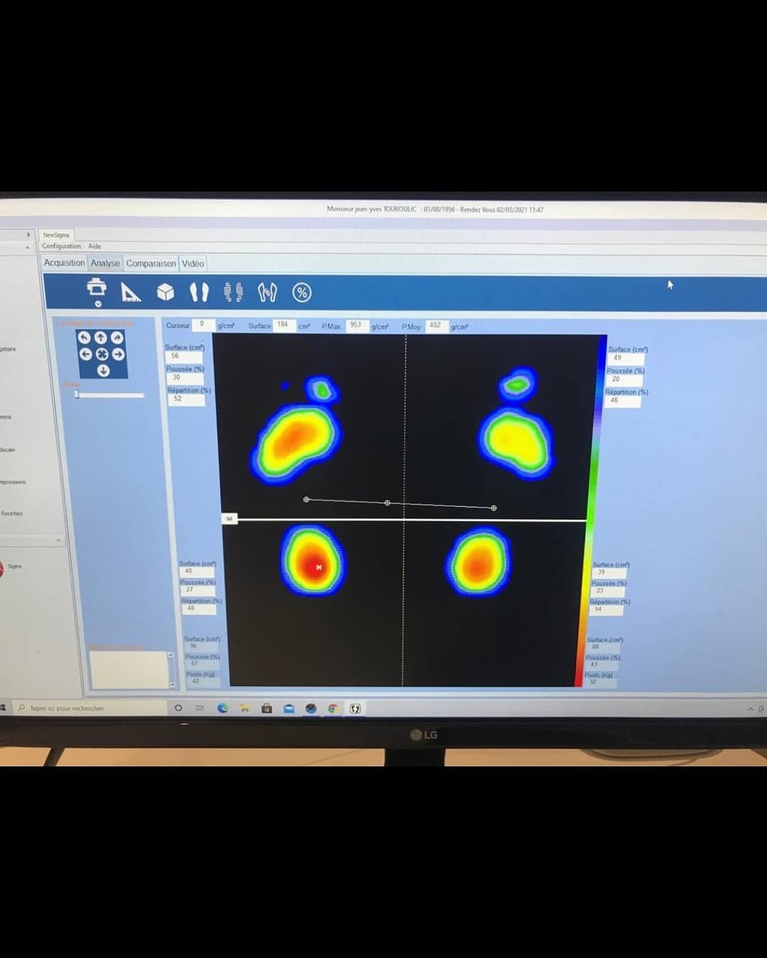 Visualisation Plateforme baropodométrique