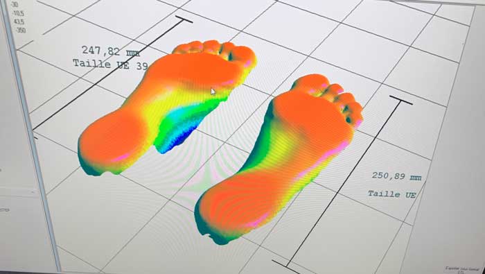 Analyse 3D du pied